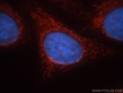 GCOM1 Rabbit anti-Human, Mouse, Rat, Polyclonal, Proteintech 150 &mu;L;