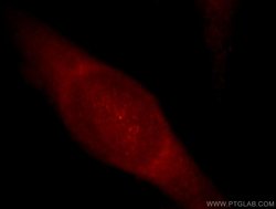 GCOM1 Rabbit anti-Human, Mouse, Rat, Polyclonal, Proteintech 150 &mu;L;