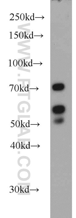LYN Rabbit anti-Human, Polyclonal, Proteintech 150 &mu;L; Unconjugated:Antibodies,