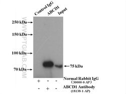 ABCD1 Rabbit anti-Human, Polyclonal, Proteintech:Antibodies:Primary Antibodies