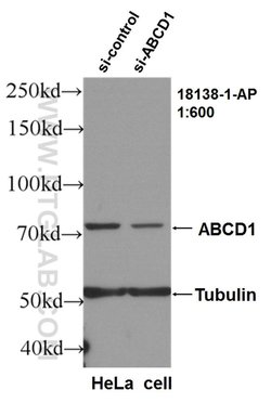 ABCD1 Rabbit anti-Human, Polyclonal, Proteintech:Antibodies:Primary Antibodies