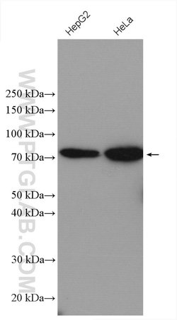 ABCD1 Rabbit anti-Human, Polyclonal, Proteintech:Antibodies:Primary Antibodies