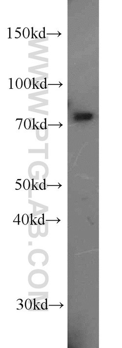 ABCD1 Rabbit anti-Human, Polyclonal, Proteintech:Antibodies:Primary Antibodies
