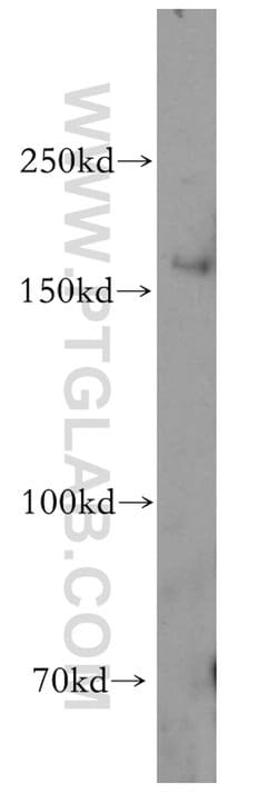 HRC Rabbit anti-Human, Mouse, Polyclonal, Proteintech 20 &mu;L; Unconjugated:Antibodies,