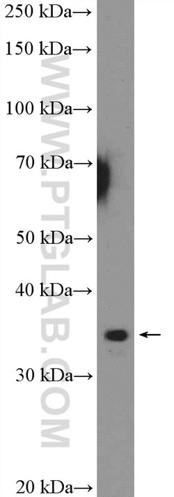 RPA4 Rabbit anti-Human, Mouse, Polyclonal, Proteintech 150 &mu;L; Unconjugated:Antibodies,