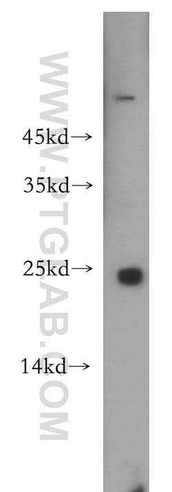 RAB9B Rabbit anti-Human, Mouse, Rat, Polyclonal, Proteintech:Antibodies:Primary
