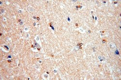 FAM118B Rabbit anti-Human, Mouse, Rat, Polyclonal, Proteintech:Anticuerpos:Anticuerpos