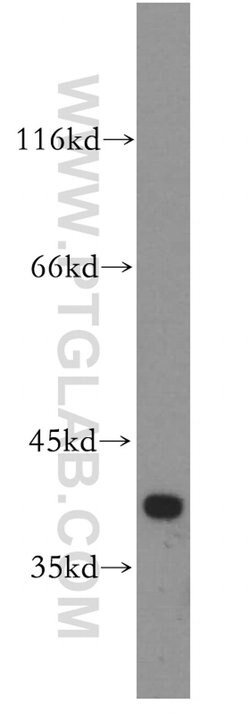 FAM118B Rabbit anti-Human, Mouse, Rat, Polyclonal, Proteintech:Anticuerpos:Anticuerpos
