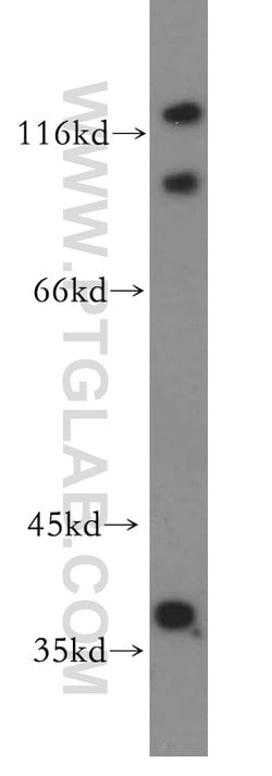 FAM118B Rabbit anti-Human, Mouse, Rat, Polyclonal, Proteintech:Anticuerpos:Anticuerpos