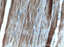 AMPK alpha 2 Rabbit anti-Human, Mouse, Rat, Polyclonal, Proteintech 150