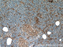 AMPK alpha 2 Rabbit anti-Human, Mouse, Rat, Polyclonal, Proteintech 150