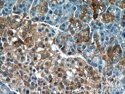 AMPK alpha 2 Rabbit anti-Human, Mouse, Rat, Polyclonal, Proteintech 150