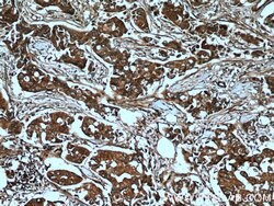 AMPK alpha 2 Rabbit anti-Human, Mouse, Rat, Polyclonal, Proteintech 150