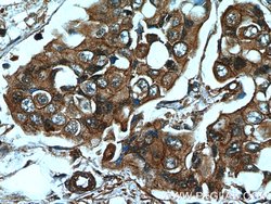 AMPK alpha 2 Rabbit anti-Human, Mouse, Rat, Polyclonal, Proteintech 150