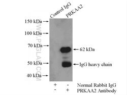 AMPK alpha 2 Rabbit anti-Human, Mouse, Rat, Polyclonal, Proteintech 150
