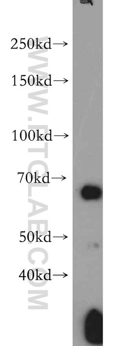 AMPK alpha 2 Rabbit anti-Human, Mouse, Rat, Polyclonal, Proteintech 150