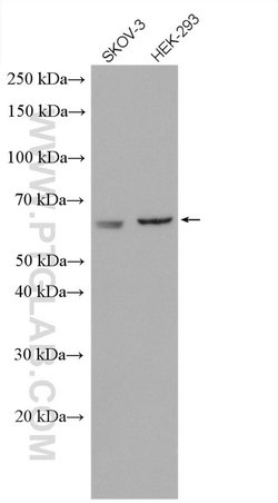 AMPK alpha 2 Rabbit anti-Human, Mouse, Rat, Polyclonal, Proteintech 150