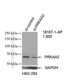 AMPK alpha 2 Rabbit anti-Human, Mouse, Rat, Polyclonal, Proteintech 150