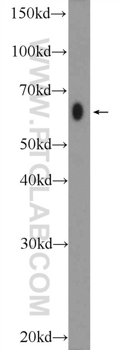 AMPK alpha 2 Rabbit anti-Human, Mouse, Rat, Polyclonal, Proteintech 150