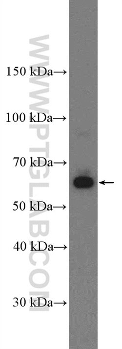 AMPK alpha 2 Rabbit anti-Human, Mouse, Rat, Polyclonal, Proteintech 150