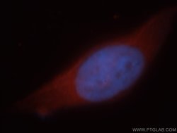 HEPACAM Rabbit anti-Human, Mouse, Rat, Polyclonal, Proteintech:Antibodies:Primary