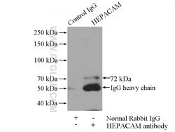 HEPACAM Rabbit anti-Human, Mouse, Rat, Polyclonal, Proteintech:Antibodies:Primary