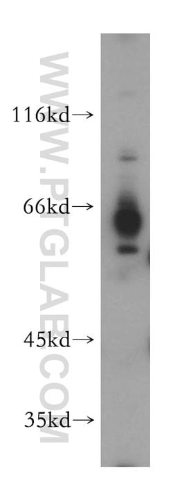 HEPACAM Rabbit anti-Human, Mouse, Rat, Polyclonal, Proteintech:Antibodies:Primary