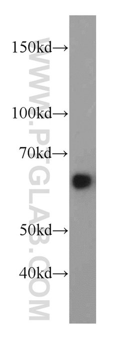 HEPACAM Rabbit anti-Human, Mouse, Rat, Polyclonal, Proteintech:Antibodies:Primary