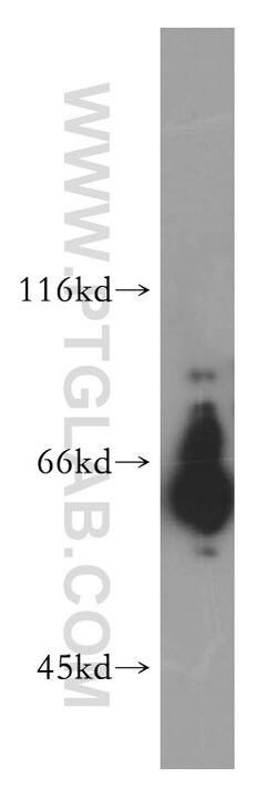 HEPACAM Rabbit anti-Human, Mouse, Rat, Polyclonal, Proteintech:Antibodies:Primary