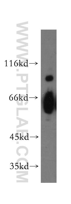 HEPACAM Rabbit anti-Human, Mouse, Rat, Polyclonal, Proteintech:Antibodies:Primary