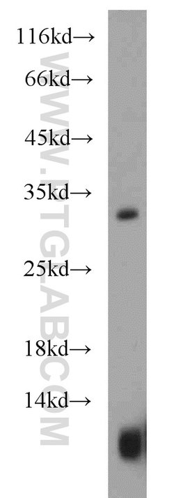 CST8 Rabbit anti-Human, Polyclonal, Proteintech:Antibodies:Primary Antibodies