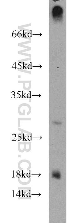 CST8 Rabbit anti-Human, Polyclonal, Proteintech:Antibodies:Primary Antibodies