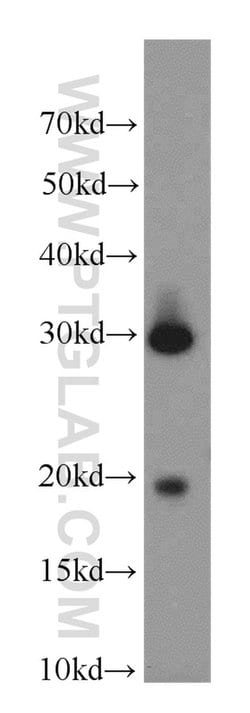 CST8 Rabbit anti-Human, Polyclonal, Proteintech:Antibodies:Primary Antibodies