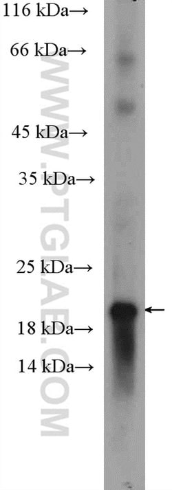 Proteintech Group Inc OMP Rabbit anti-Human, Mouse, Polyclonal, Proteintech