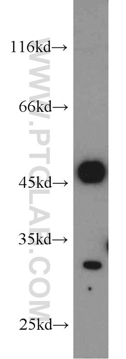 Mast Cell Chymase Rabbit anti-Human, Mouse, Rat, Polyclonal, Proteintech:Antibodies:Primary