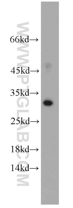 Mast Cell Chymase Rabbit anti-Human, Mouse, Rat, Polyclonal, Proteintech:Antibodies:Primary