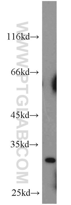 Mast Cell Chymase Rabbit anti-Human, Mouse, Rat, Polyclonal, Proteintech:Antibodies:Primary