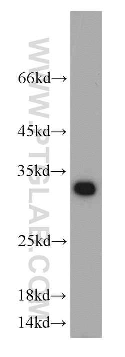 Mast Cell Chymase Rabbit anti-Human, Mouse, Rat, Polyclonal, Proteintech:Antibodies:Primary