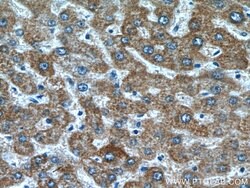 LACTB Rabbit anti-Human, Mouse, Rat, Polyclonal, Proteintech:Antibodies:Primary