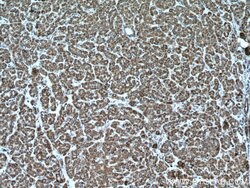 LACTB Rabbit anti-Human, Mouse, Rat, Polyclonal, Proteintech:Antibodies:Primary