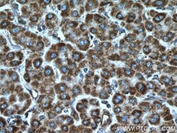 LACTB Rabbit anti-Human, Mouse, Rat, Polyclonal, Proteintech:Antibodies:Primary