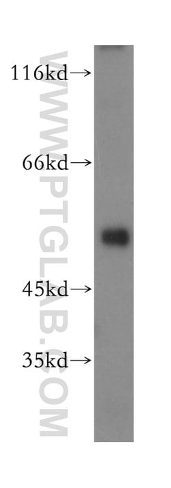 LACTB Rabbit anti-Human, Mouse, Rat, Polyclonal, Proteintech:Antibodies:Primary