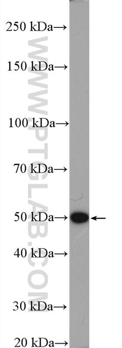 LACTB Rabbit anti-Human, Mouse, Rat, Polyclonal, Proteintech:Antibodies:Primary