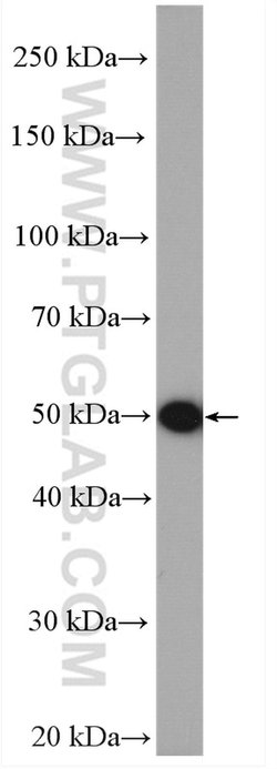 LACTB Rabbit anti-Human, Mouse, Rat, Polyclonal, Proteintech:Antibodies:Primary