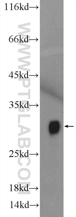 Histone H1 Rabbit anti-Human, Mouse, Rat, Polyclonal, Proteintech:Antibodies:Primary