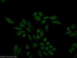 PBX1 Rabbit anti-Human, Mouse, Rat, Polyclonal, Proteintech:Antibodies:Primary