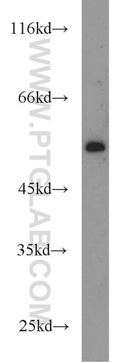 PBX1 Rabbit anti-Human, Mouse, Rat, Polyclonal, Proteintech:Antibodies:Primary