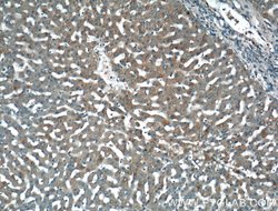 LSR Rabbit anti-Human, Mouse, Rat, Polyclonal, Proteintech 150 &mu;L; Unconjugated:Antibodies,
