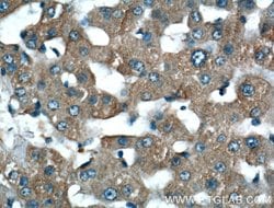 LSR Rabbit anti-Human, Mouse, Rat, Polyclonal, Proteintech 150 &mu;L; Unconjugated:Antibodies,