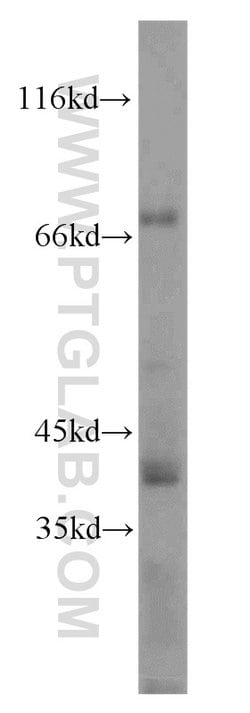 LSR Rabbit anti-Human, Mouse, Rat, Polyclonal, Proteintech 150 &mu;L; Unconjugated:Antibodies,